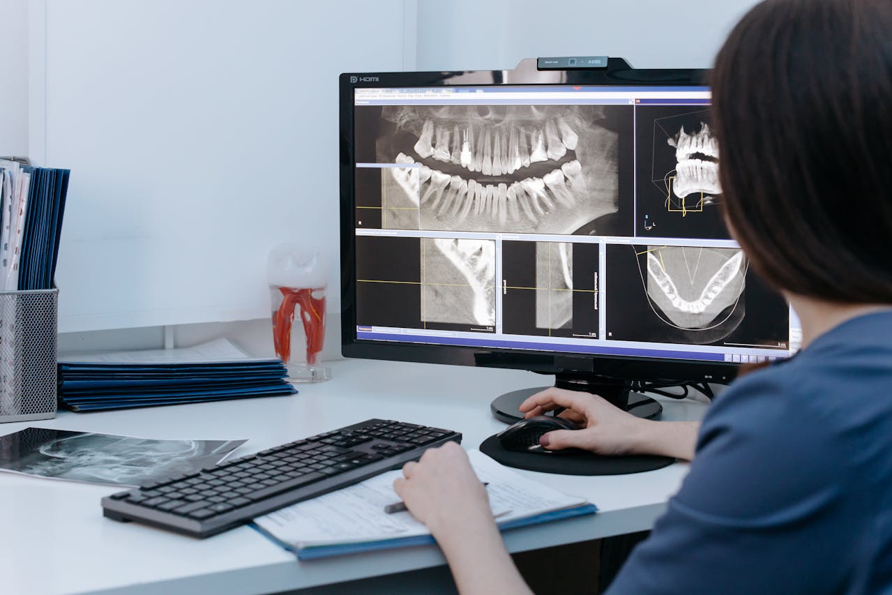 Dental X Ray photo