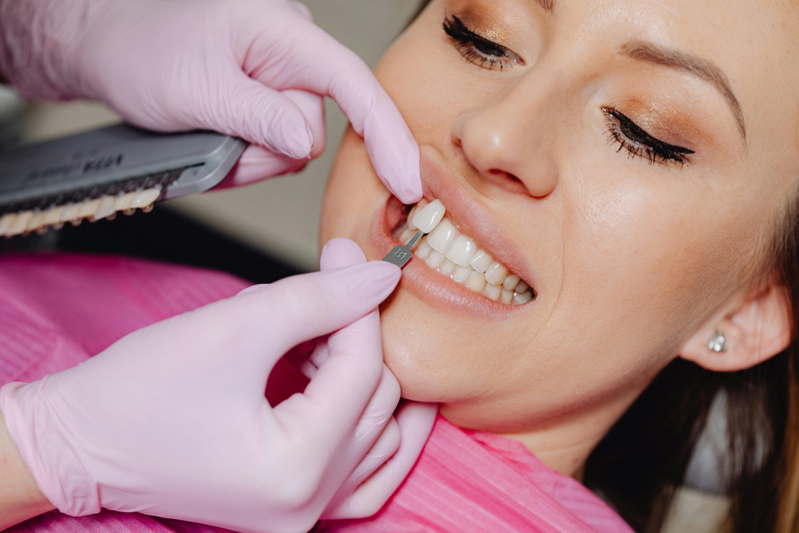 A photo showing teeth whitening process